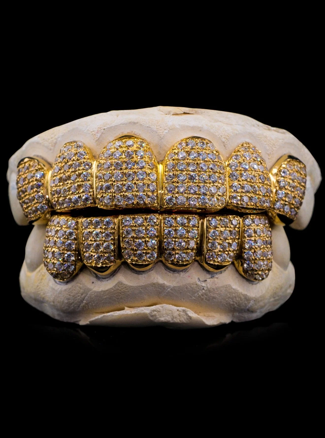Custom Grillz — Regular Thickness